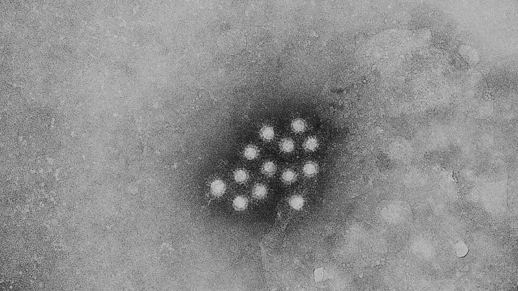 Hepatitis A microscopio