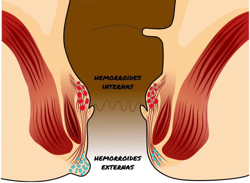Anatomia hemorroides
